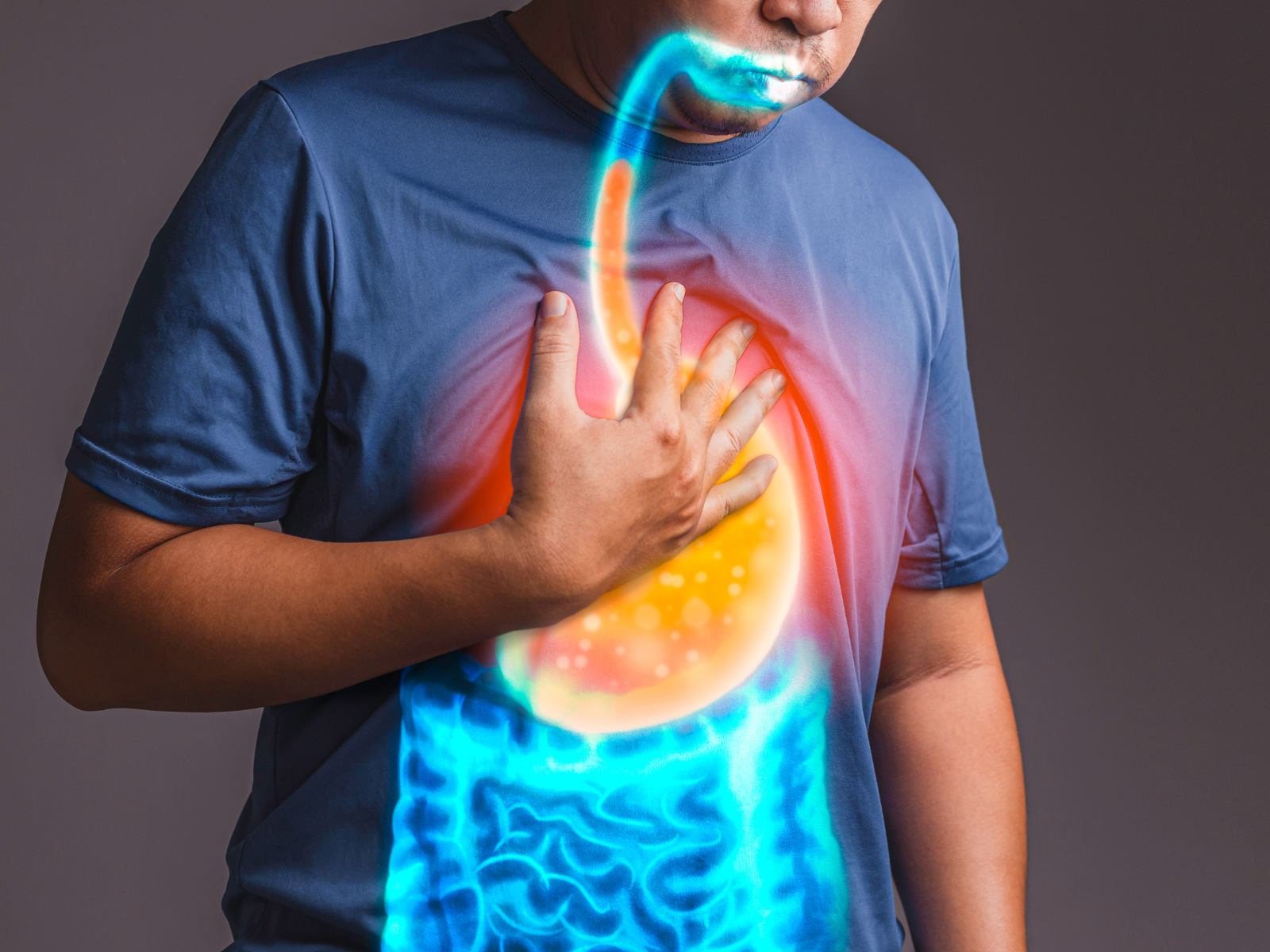reflusso gastroesofageo